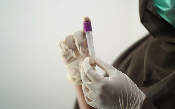 Sexuelle Gesundheit: Testmöglichkeiten in deiner Stadt